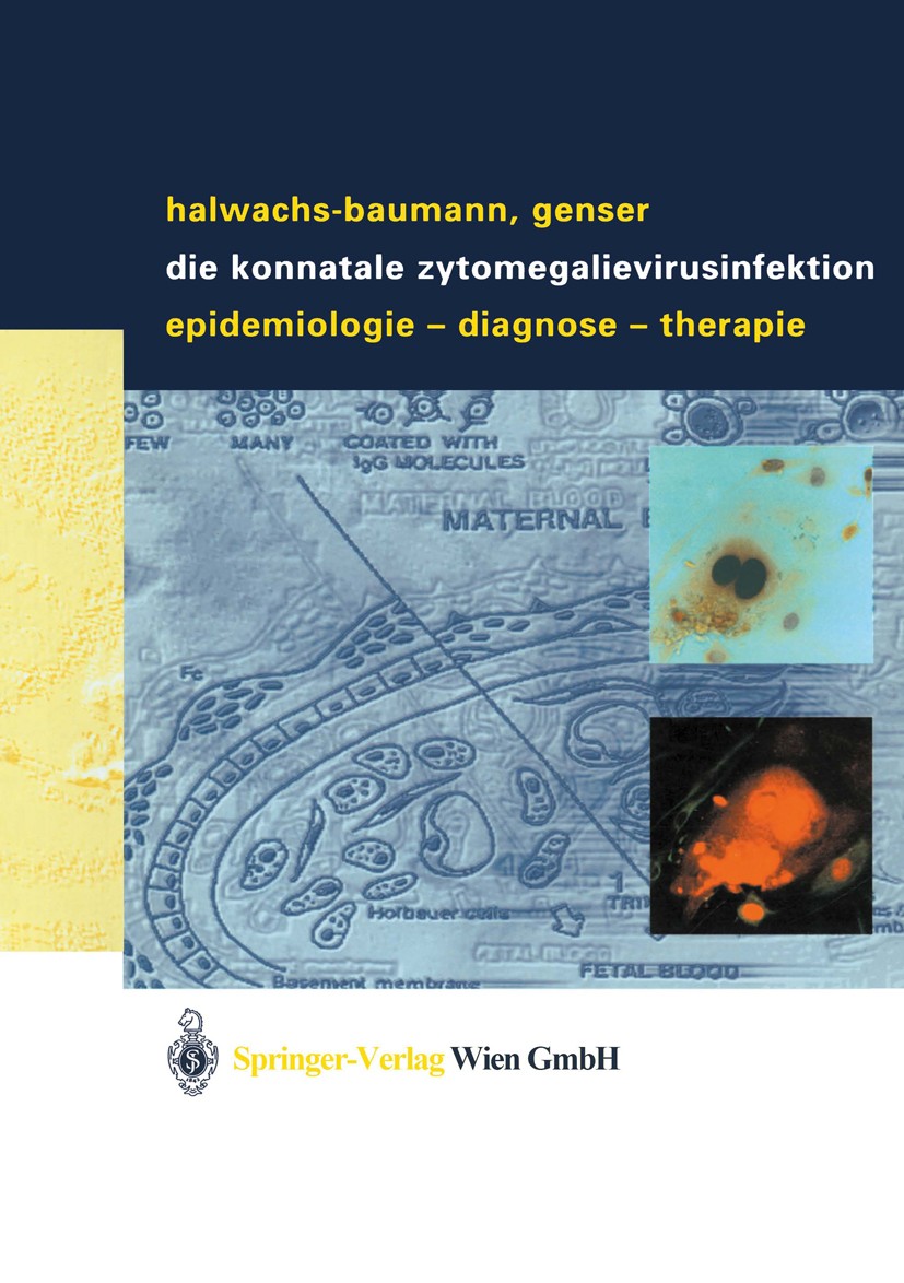 Titlebook: Die konnatale Zytomegalievirusinfektion; Epidemiologie - Diag Gabriele Halwachs-Baumann,Bernd Genser Book 2003 Springer-Verlag Wien 2003 Im Titlebook: Die konnatale Zytomegalievirusinfektion; Epidemiologie - Diag Gabriele Halwachs-Baumann,Bernd Genser Book 2003 Springer-Verlag Wien 2003 Im