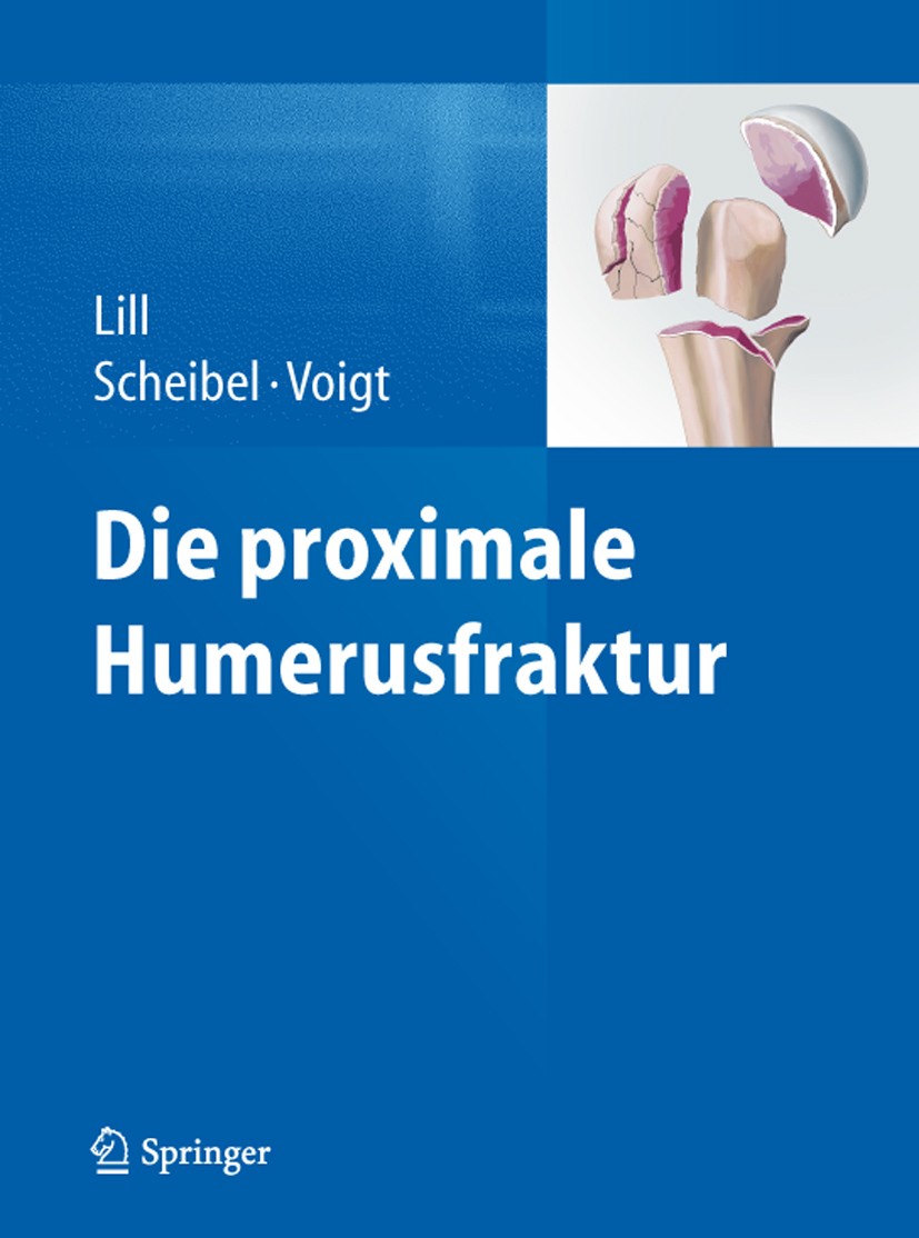 Titlebook: Die proximale Humerusfraktur; Helmut Lill,Markus Scheibel,Christine Voigt Book 2014 Springer-Verlag Berlin Heidelberg 2014 Titlebook: Die proximale Humerusfraktur; Helmut Lill,Markus Scheibel,Christine Voigt Book 2014 Springer-Verlag Berlin Heidelberg 2014
