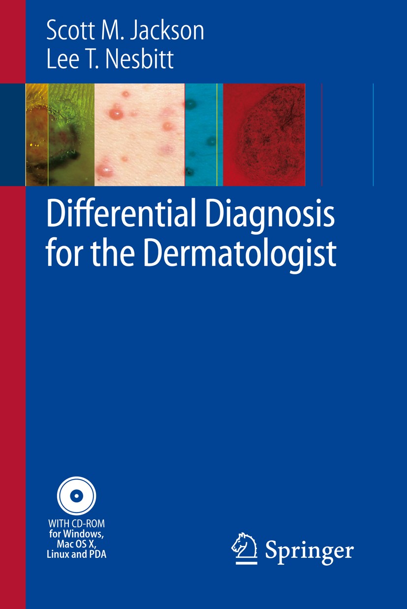 Titlebook: Differential Diagnosis for the Dermatologist; Scott Jackson,Lee T. Nesbitt Book 20081st edition Springer-Verlag Berlin Heidelberg 2008 dia Titlebook: Differential Diagnosis for the Dermatologist; Scott Jackson,Lee T. Nesbitt Book 20081st edition Springer-Verlag Berlin Heidelberg 2008 dia