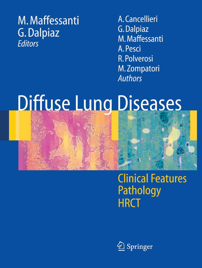 Titlebook: Diffuse Lung Diseases; Clinical Features, P Alessandra Cancellieri,Giorgia Dalpiaz,Maurizio Zo Book 2006 Springer-Verlag Milan 2006 CT.High Titlebook: Diffuse Lung Diseases; Clinical Features, P Alessandra Cancellieri,Giorgia Dalpiaz,Maurizio Zo Book 2006 Springer-Verlag Milan 2006 CT.High