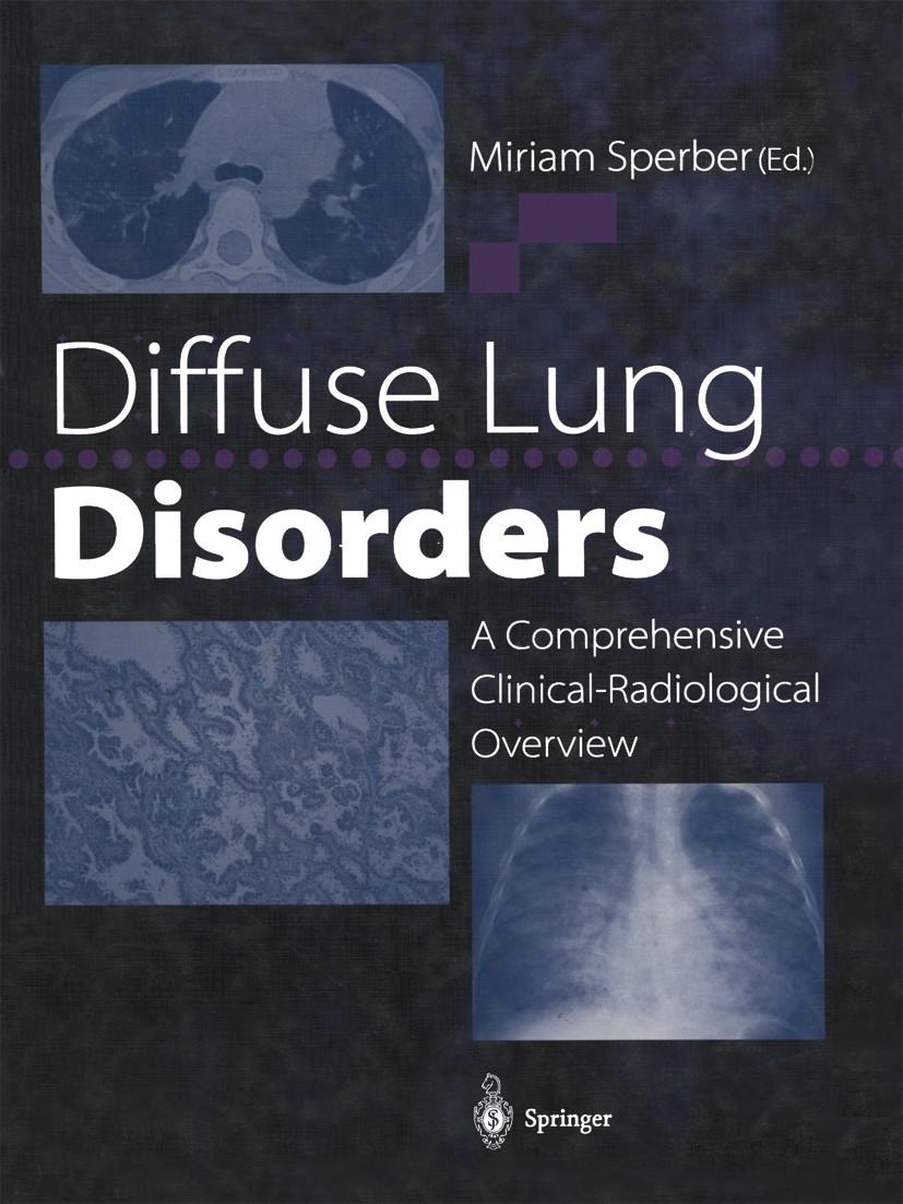 Titlebook: Diffuse Lung Disorders; A Comprehensive Clin Miriam Sperber (Consultant Radiologist) Book 1999 Springer-Verlag London 1999 Atmen.Stress.bio Titlebook: Diffuse Lung Disorders; A Comprehensive Clin Miriam Sperber (Consultant Radiologist) Book 1999 Springer-Verlag London 1999 Atmen.Stress.bio
