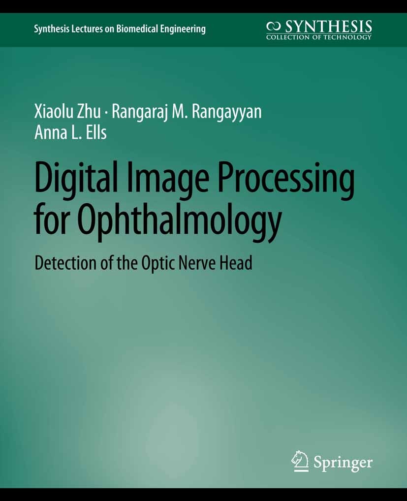Titlebook: Digital Image Processing for Ophthalmology; Detection of the Opt Xiaolu Zhu,Rangaraj M. Rangayyan,Anna L. Ells Book 2011 Springer Nature Sw Titlebook: Digital Image Processing for Ophthalmology; Detection of the Opt Xiaolu Zhu,Rangaraj M. Rangayyan,Anna L. Ells Book 2011 Springer Nature Sw