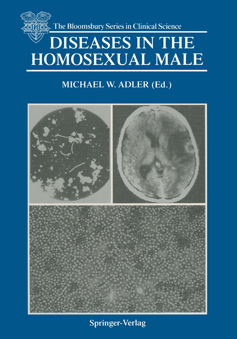 Titlebook: Diseases in the Homosexual Male; Michael W. Adler (Professor of Genito-Urinary Medi Book 1988 Springer-Verlag Berlin Heidelberg 1988 AIDS. Titlebook: Diseases in the Homosexual Male; Michael W. Adler (Professor of Genito-Urinary Medi Book 1988 Springer-Verlag Berlin Heidelberg 1988 AIDS.