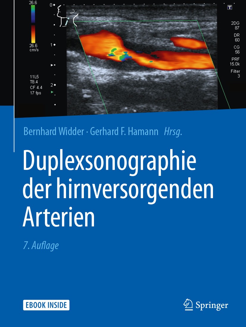 Titlebook: Duplexsonographie der hirnversorgenden Arterien; Bernhard Widder,Gerhard F. Hamann Book 2018Latest edition Springer-Verlag GmbH Deutschlan Titlebook: Duplexsonographie der hirnversorgenden Arterien; Bernhard Widder,Gerhard F. Hamann Book 2018Latest edition Springer-Verlag GmbH Deutschlan