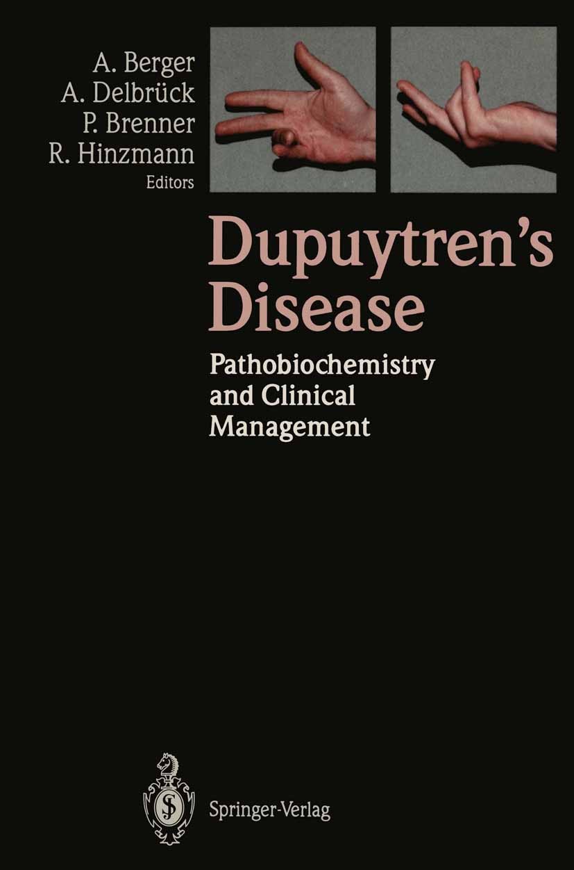 Titlebook: Dupuytren’s Disease; Pathobiochemistry an Alfred Berger,Axel Delbrück,Rolf Hinzmann Conference proceedings 1994 Springer-Verlag Berlin Heid Titlebook: Dupuytren’s Disease; Pathobiochemistry an Alfred Berger,Axel Delbrück,Rolf Hinzmann Conference proceedings 1994 Springer-Verlag Berlin Heid