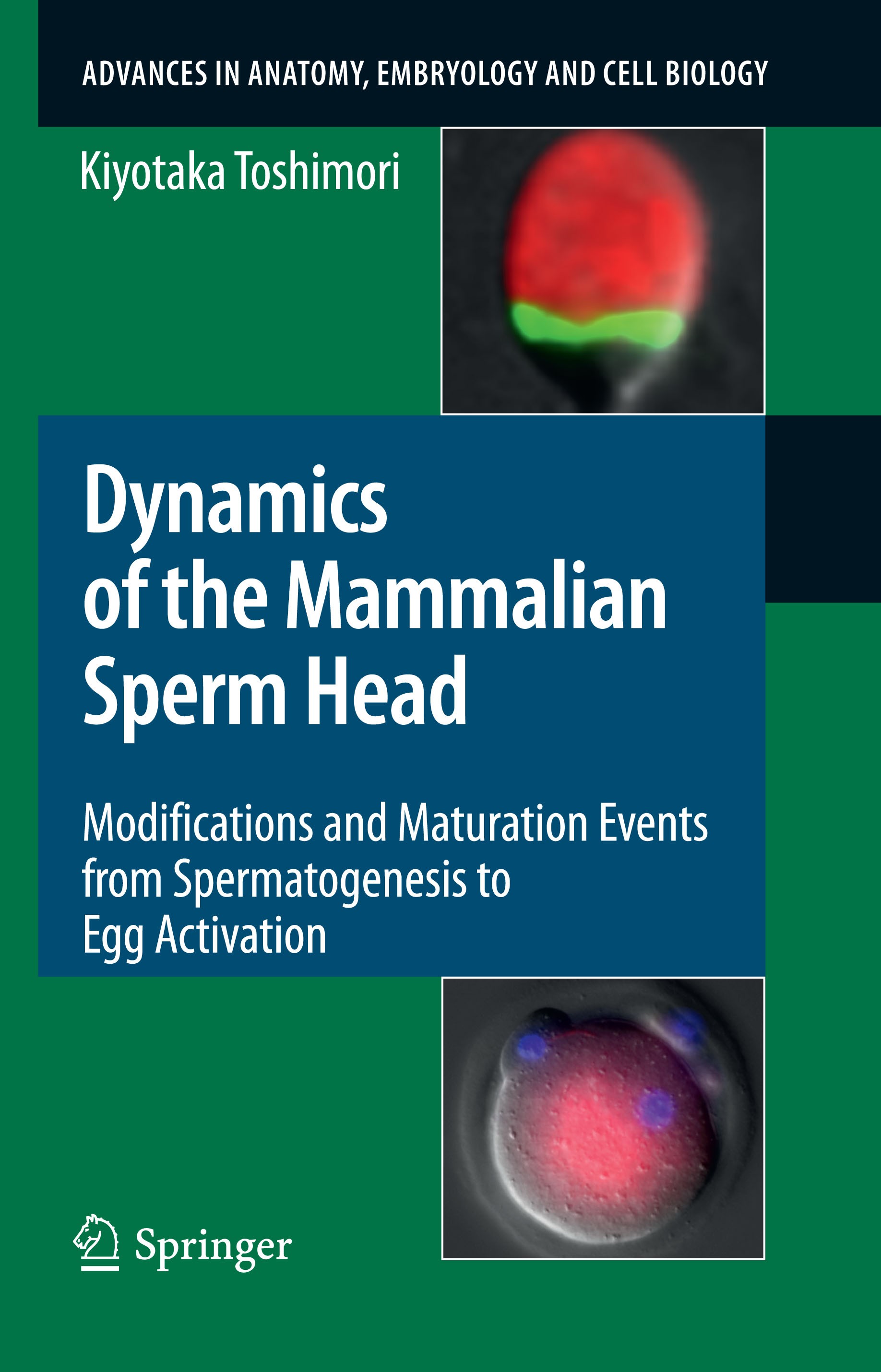 Titlebook: Dynamics of the Mammalian Sperm Head; Modifications and Ma Kiyotaka Toshimori Book 2009 The Editor(s) (if applicable) and The Author(s), un Titlebook: Dynamics of the Mammalian Sperm Head; Modifications and Ma Kiyotaka Toshimori Book 2009 The Editor(s) (if applicable) and The Author(s), un