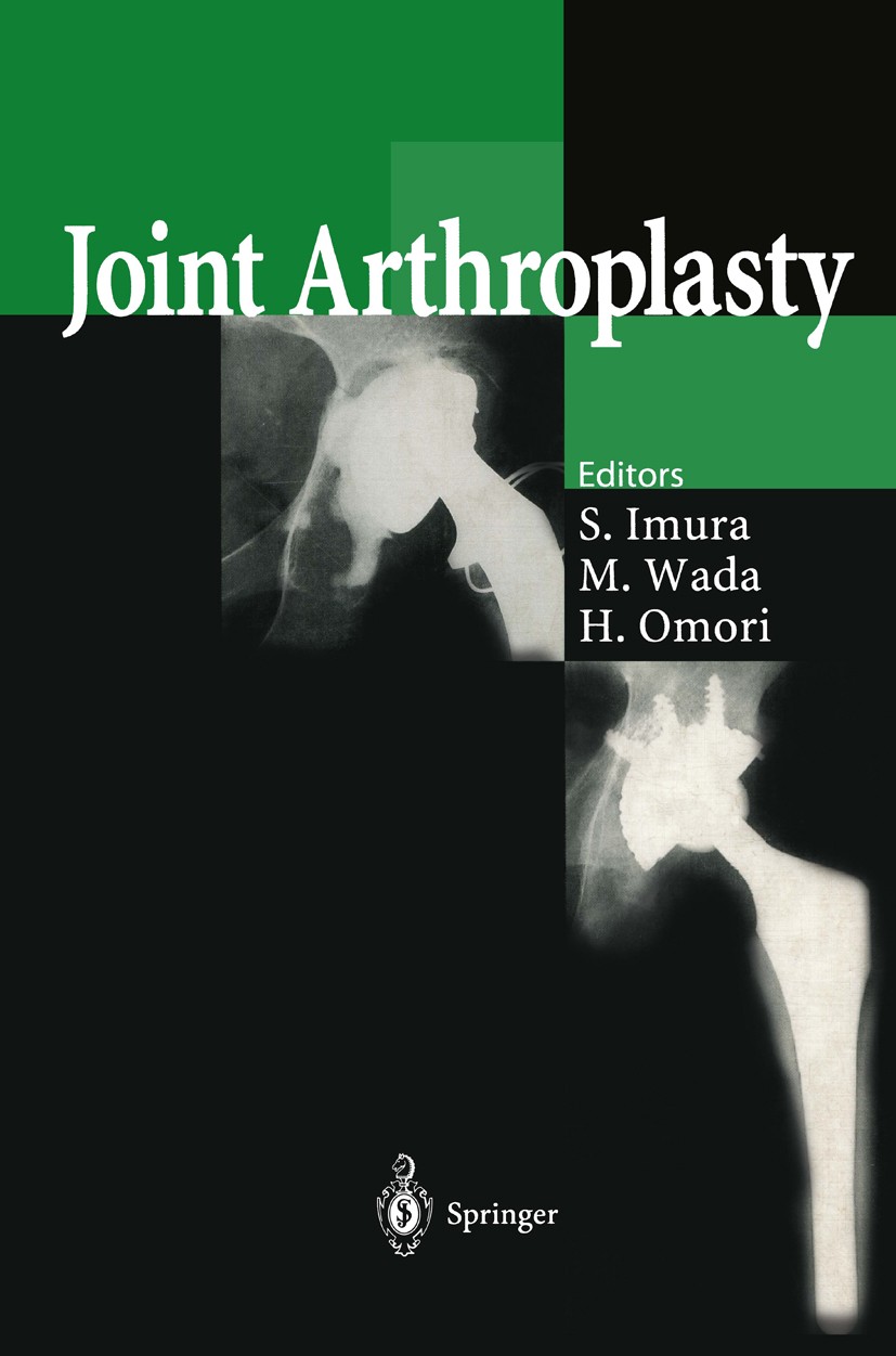 Titlebook: Joint Arthroplasty; Shinichi Imura (Professor and Chairman),Makoto Wad Conference proceedings 1999 Springer-Verlag Tokyo 1999 arthroplasty Titlebook: Joint Arthroplasty; Shinichi Imura (Professor and Chairman),Makoto Wad Conference proceedings 1999 Springer-Verlag Tokyo 1999 arthroplasty