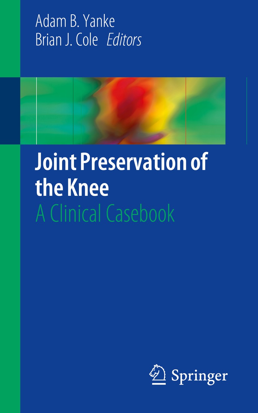 Titlebook: Joint Preservation of the Knee; A Clinical Casebook Adam B. Yanke,Brian J. Cole Book 2019 Springer Nature Switzerland AG 2019 Articular car Titlebook: Joint Preservation of the Knee; A Clinical Casebook Adam B. Yanke,Brian J. Cole Book 2019 Springer Nature Switzerland AG 2019 Articular car