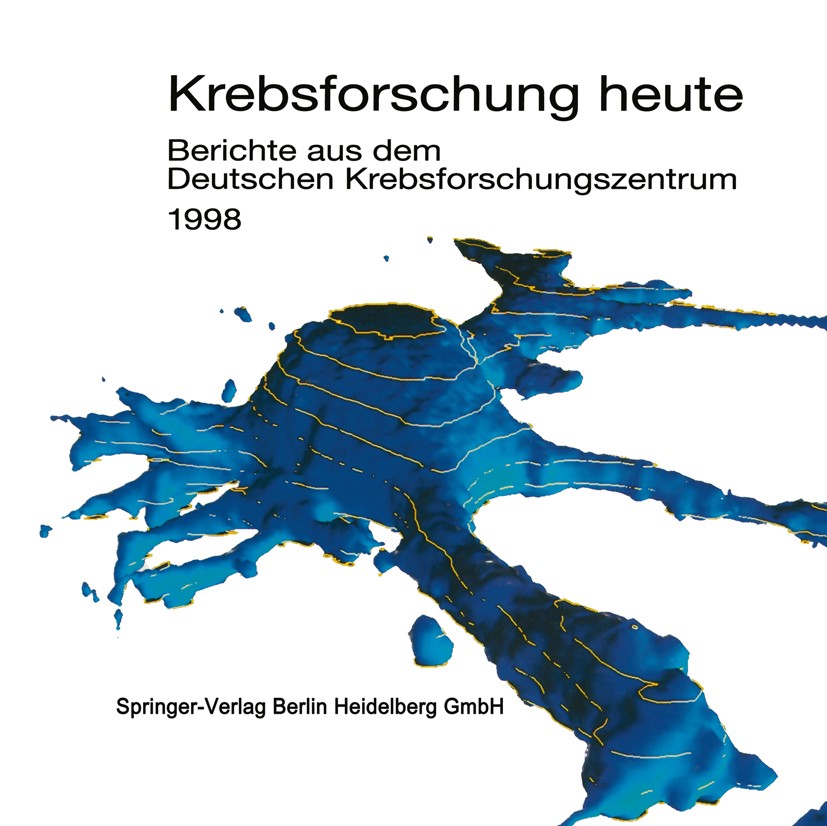 Titlebook: Krebsforschung heute; Berichte aus dem Deu Deutsches Krebsforschungszentrum Book 1998 Springer-Verlag Berlin Heidelberg 1998 Diagnostik.Ges Titlebook: Krebsforschung heute; Berichte aus dem Deu Deutsches Krebsforschungszentrum Book 1998 Springer-Verlag Berlin Heidelberg 1998 Diagnostik.Ges