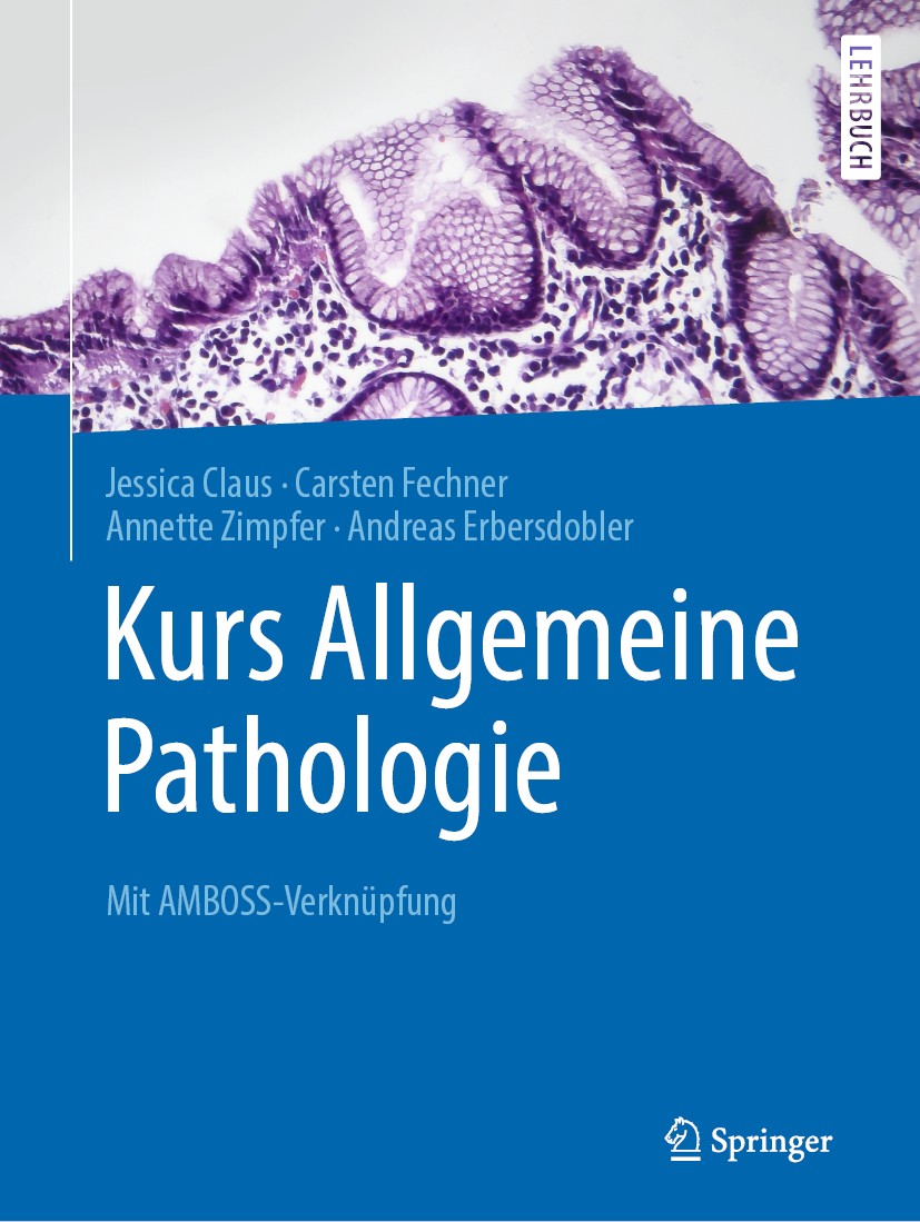 Titlebook: Kurs Allgemeine Pathologie; Mit AMBOSS-Verknüpfu Jessica Claus,Carsten Fechner,Andreas Erbersdobler Textbook 2019 Springer-Verlag GmbH Deut Titlebook: Kurs Allgemeine Pathologie; Mit AMBOSS-Verknüpfu Jessica Claus,Carsten Fechner,Andreas Erbersdobler Textbook 2019 Springer-Verlag GmbH Deut