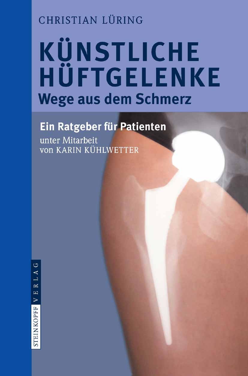Titlebook: Künstliche Hüftgelenke; Wege aus dem Schmerz Christian Lüring Book 2010 Steinkopff-Verlag Darmstadt 2010 Angst.Arthrose.Betroffene.Bewegung Titlebook: Künstliche Hüftgelenke; Wege aus dem Schmerz Christian Lüring Book 2010 Steinkopff-Verlag Darmstadt 2010 Angst.Arthrose.Betroffene.Bewegung