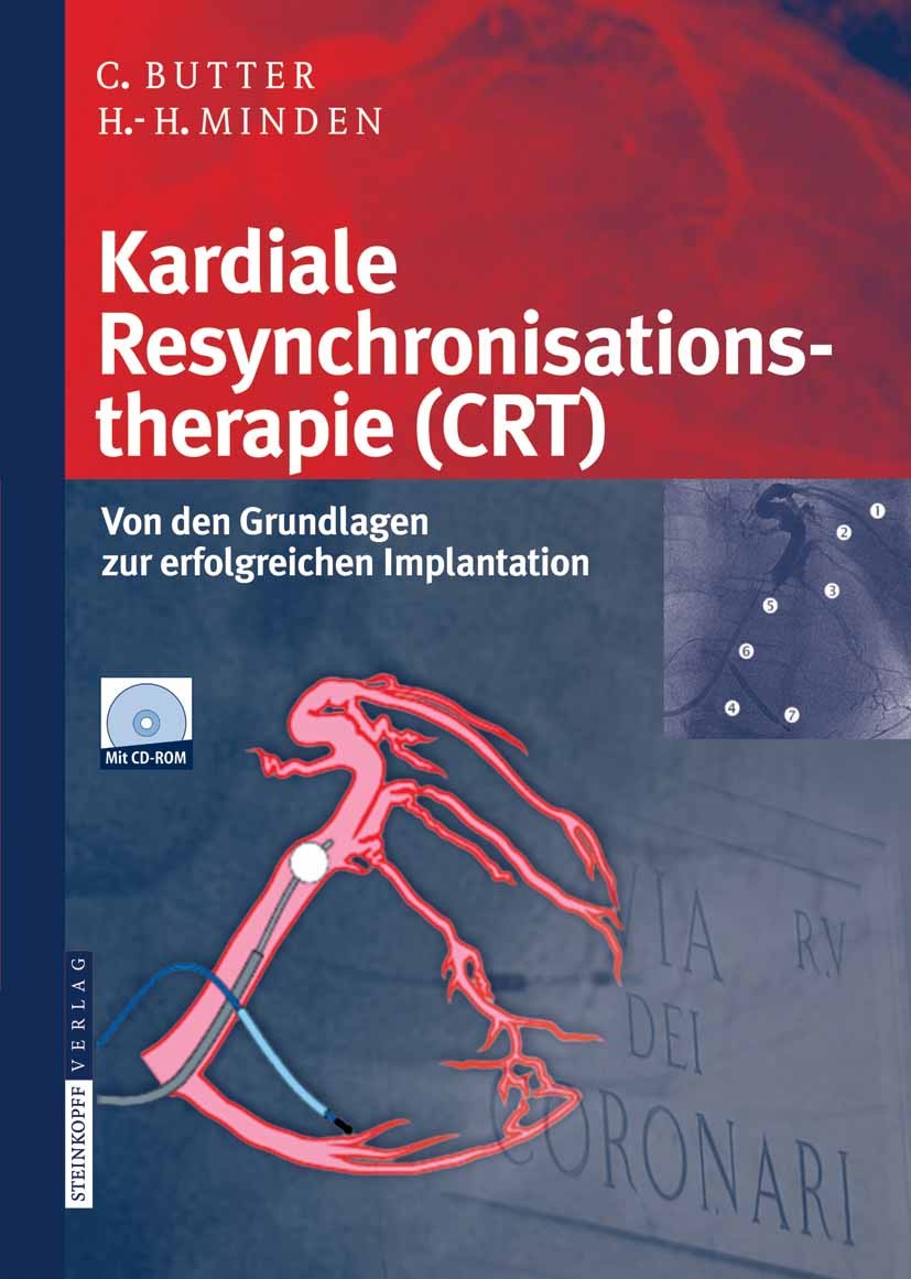 Titlebook: Kardiale Resynchronisationstherapie (CRT); Von den Grundlagen z C. Butter,H.-H. Minden Book 2008 Steinkopff-Verlag Darmstadt 2008 CRT.Herzi Titlebook: Kardiale Resynchronisationstherapie (CRT); Von den Grundlagen z C. Butter,H.-H. Minden Book 2008 Steinkopff-Verlag Darmstadt 2008 CRT.Herzi