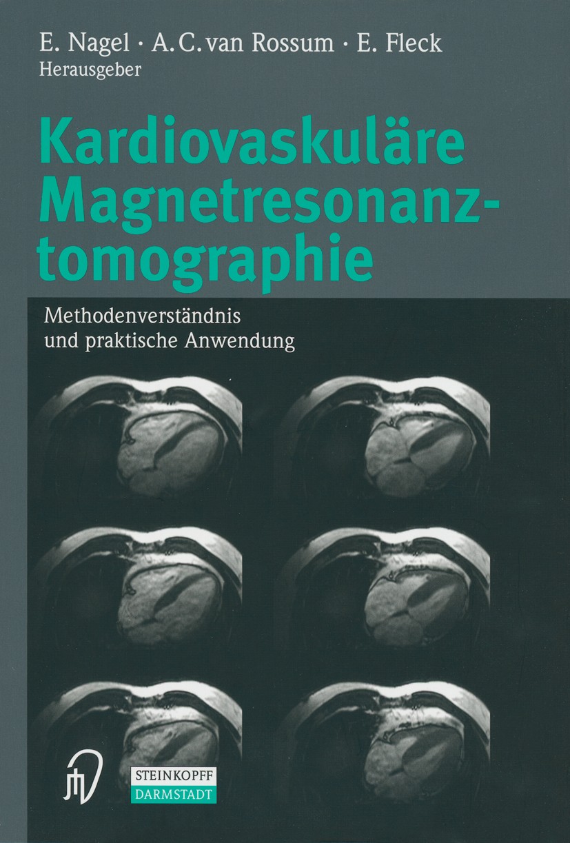 Titlebook: Kardiovaskuläre Magnetresonanztomographie; Methodenverständnis Eike Nagel,Albert C. Rossum,Eckart Fleck Book 2002 Springer-Verlag Berlin H Titlebook: Kardiovaskuläre Magnetresonanztomographie; Methodenverständnis Eike Nagel,Albert C. Rossum,Eckart Fleck Book 2002 Springer-Verlag Berlin H