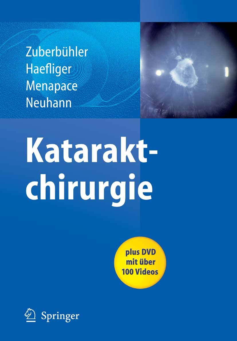 Titlebook: Kataraktchirurgie; Bruno Zuberbühler,Eduard Haefliger,Thomas Neuhann Book 2008 Springer-Verlag Berlin Heidelberg 2008 Biometrie.Kataraktch Titlebook: Kataraktchirurgie; Bruno Zuberbühler,Eduard Haefliger,Thomas Neuhann Book 2008 Springer-Verlag Berlin Heidelberg 2008 Biometrie.Kataraktch