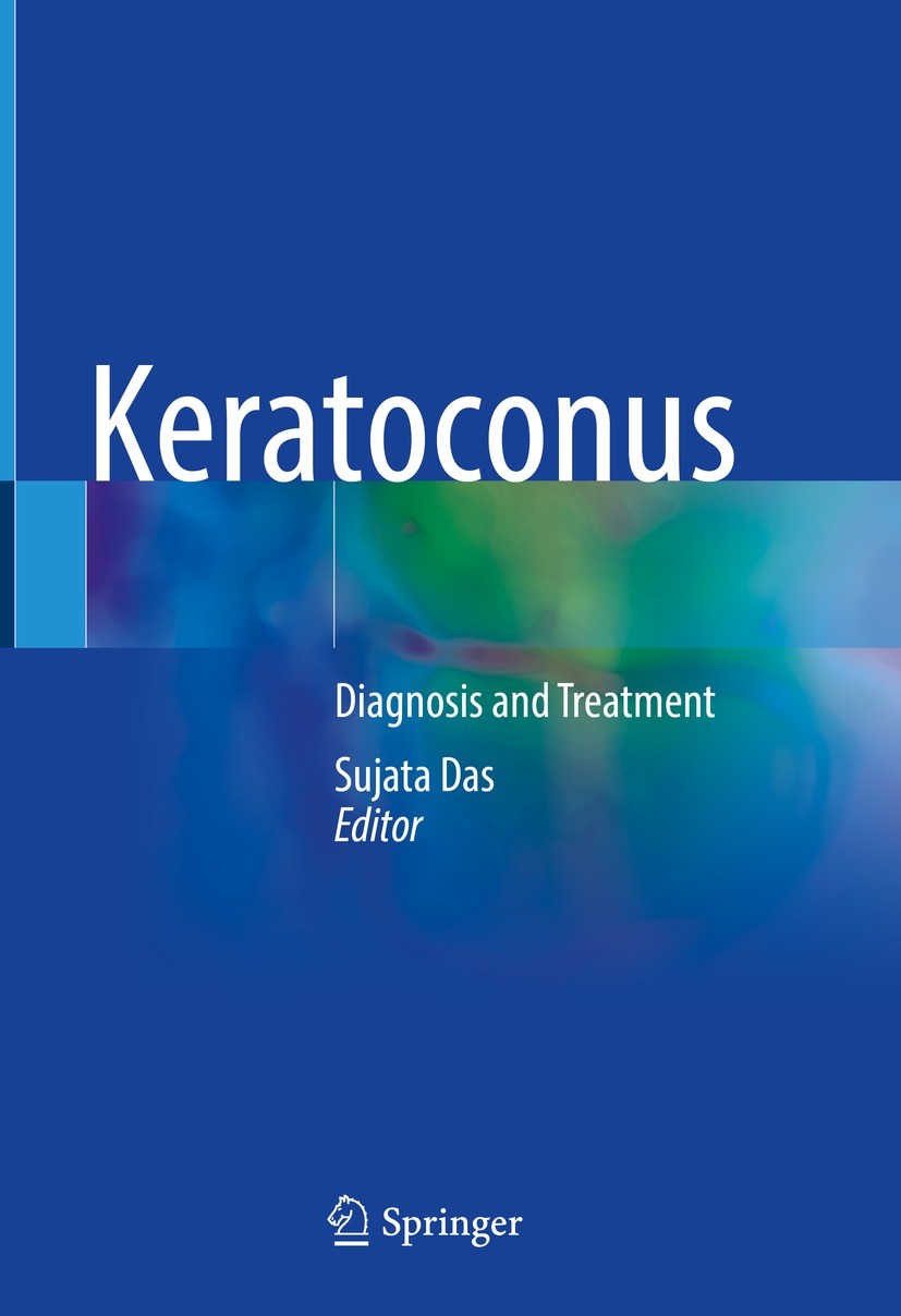 Titlebook: Keratoconus; Diagnosis and Treatm Sujata Das Book 2022 The Editor(s) (if applicable) and The Author(s), under exclusive license to Springer Titlebook: Keratoconus; Diagnosis and Treatm Sujata Das Book 2022 The Editor(s) (if applicable) and The Author(s), under exclusive license to Springer