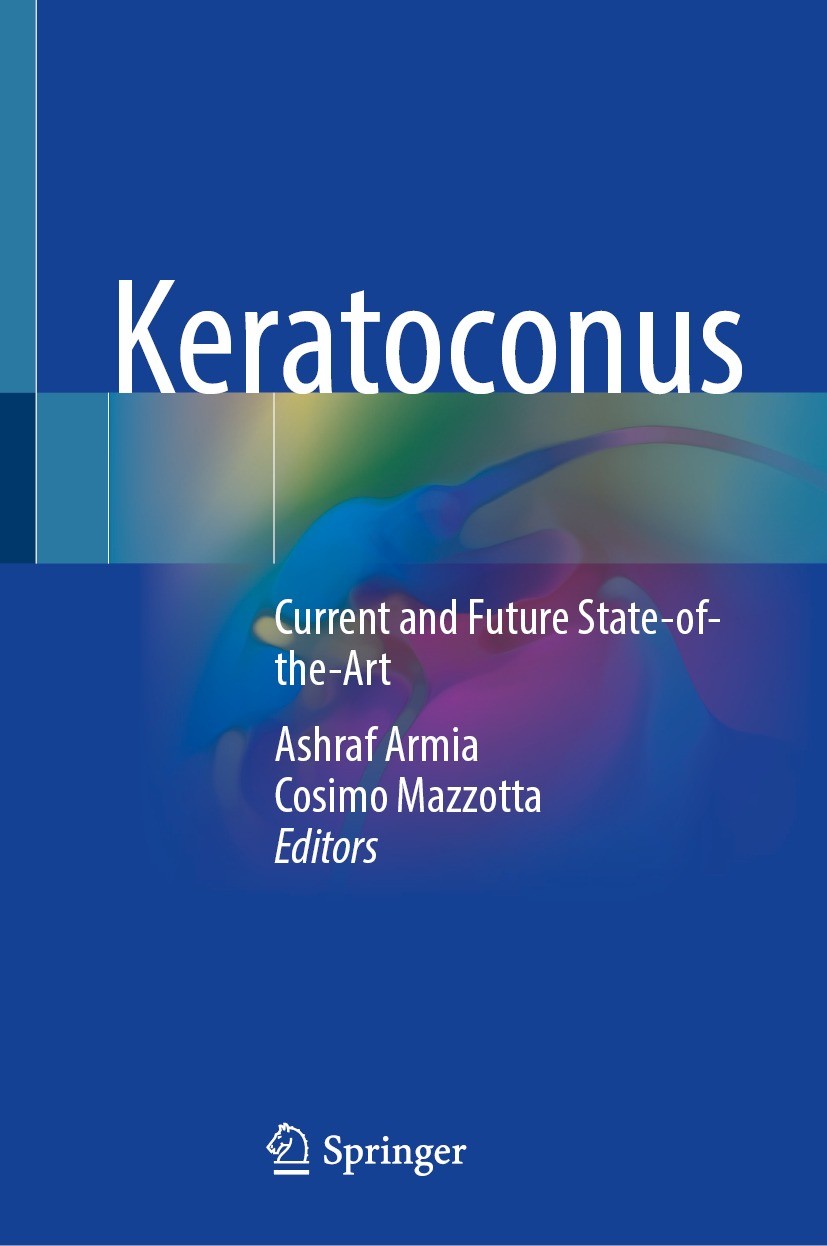 Titlebook: Keratoconus; Current and Future S Ashraf Armia,Cosimo Mazzotta Book 2022 The Editor(s) (if applicable) and The Author(s), under exclusive l Titlebook: Keratoconus; Current and Future S Ashraf Armia,Cosimo Mazzotta Book 2022 The Editor(s) (if applicable) and The Author(s), under exclusive l