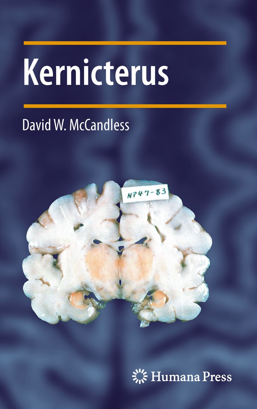 Titlebook: Kernicterus; David W. McCandless Book 2011 Springer Science+Business Media, LLC 2011 Titlebook: Kernicterus; David W. McCandless Book 2011 Springer Science+Business Media, LLC 2011