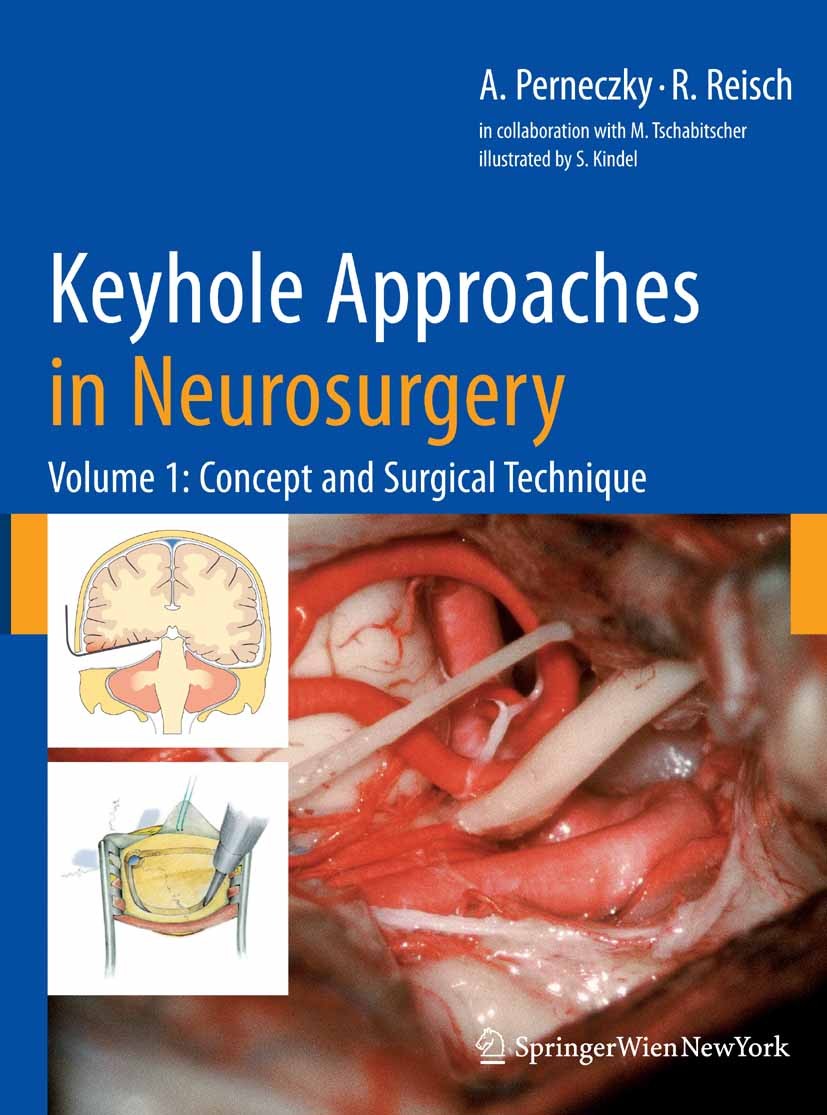 Titlebook: Keyhole Approaches in Neurosurgery; Volume 1: Concept an Axel Perneczky,Robert Reisch Book 2008 Springer-Verlag Vienna 2008 Surgery.endosco Titlebook: Keyhole Approaches in Neurosurgery; Volume 1: Concept an Axel Perneczky,Robert Reisch Book 2008 Springer-Verlag Vienna 2008 Surgery.endosco