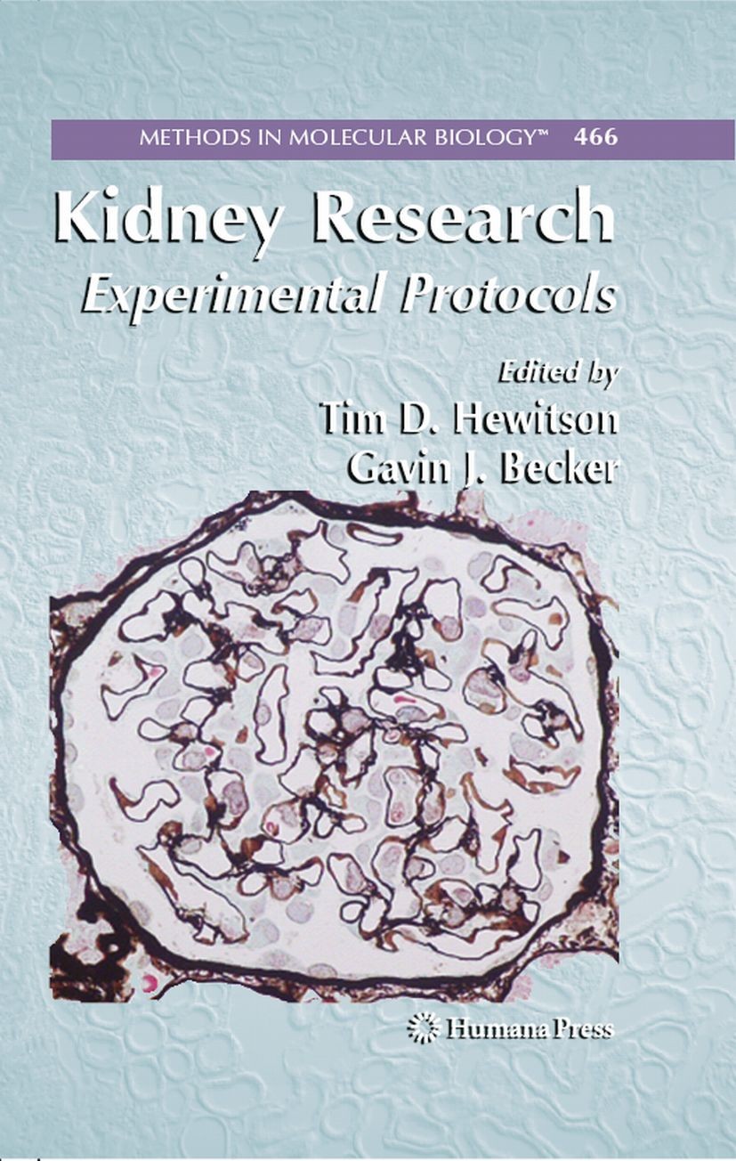 Titlebook: Kidney Research; Experimental Protoco Gavin J. Becker,Tim D. Hewitson Book 2009 The Editor(s) (if applicable) and The Author(s), under excl Titlebook: Kidney Research; Experimental Protoco Gavin J. Becker,Tim D. Hewitson Book 2009 The Editor(s) (if applicable) and The Author(s), under excl