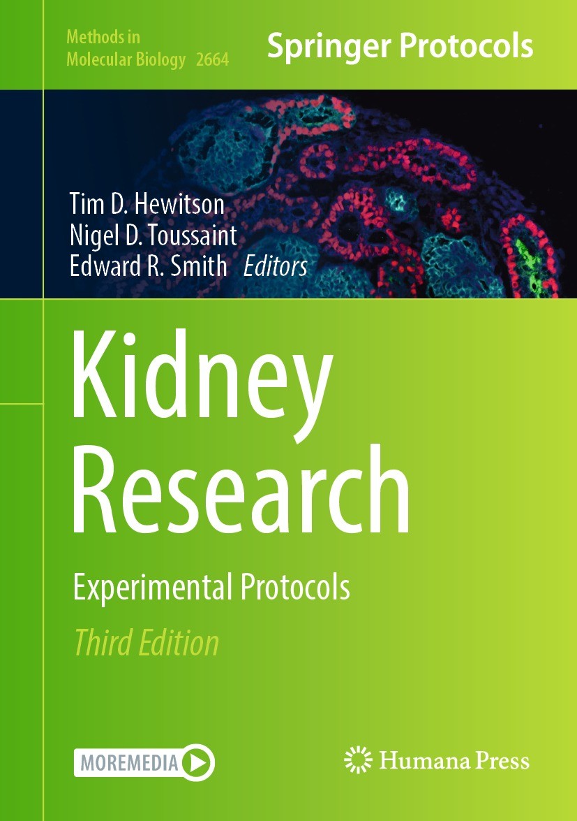 Titlebook: Kidney Research; Experimental Protoco Tim D. Hewitson,Nigel D. Toussaint,Edward R. Smith Book 2023Latest edition The Editor(s) (if applicab Titlebook: Kidney Research; Experimental Protoco Tim D. Hewitson,Nigel D. Toussaint,Edward R. Smith Book 2023Latest edition The Editor(s) (if applicab