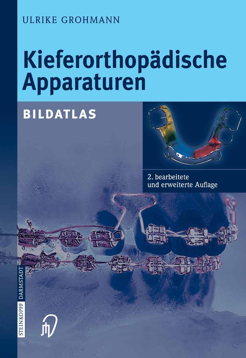 Titlebook: Kieferorthopädische Apparaturen; Bildatlas Ulrike Grohmann Book 2005Latest edition Steinkopff-Verlag Darmstadt 2005 Anwendung.Behandlung.El Titlebook: Kieferorthopädische Apparaturen; Bildatlas Ulrike Grohmann Book 2005Latest edition Steinkopff-Verlag Darmstadt 2005 Anwendung.Behandlung.El
