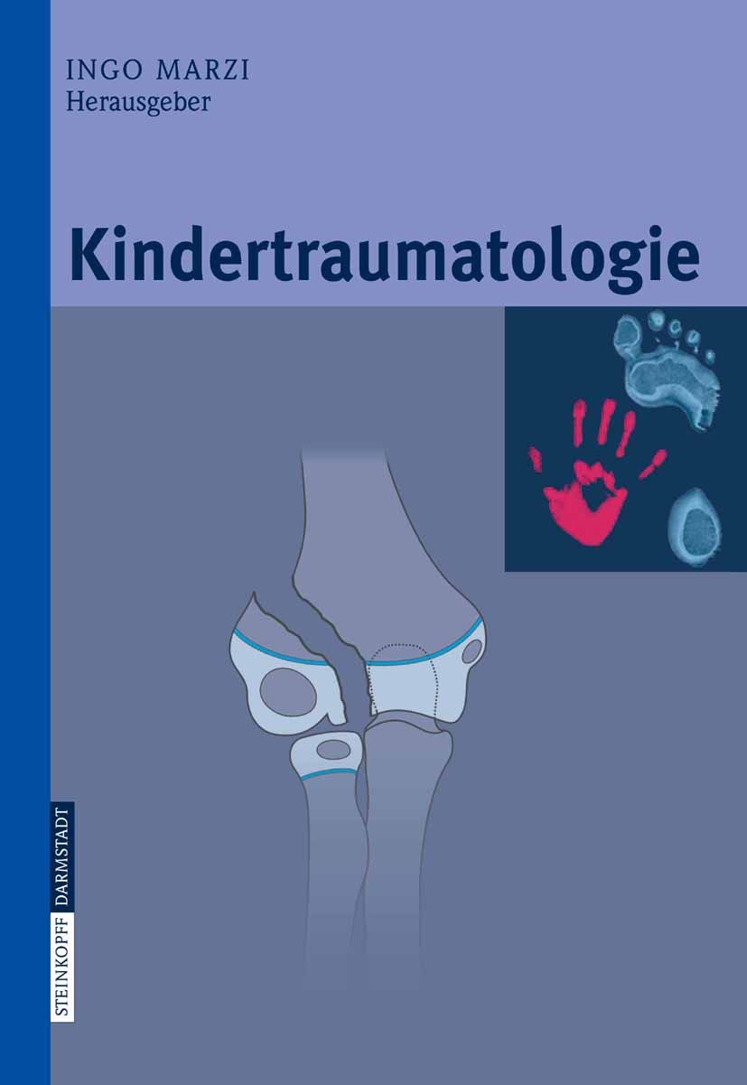 Titlebook: Kindertraumatologie; Ingo Marzi Book 20061st edition Steinkopff-Verlag Darmstadt 2006 Chirurgie.Kindesalter.Osteosynthese.Traumatologie.Un Titlebook: Kindertraumatologie; Ingo Marzi Book 20061st edition Steinkopff-Verlag Darmstadt 2006 Chirurgie.Kindesalter.Osteosynthese.Traumatologie.Un