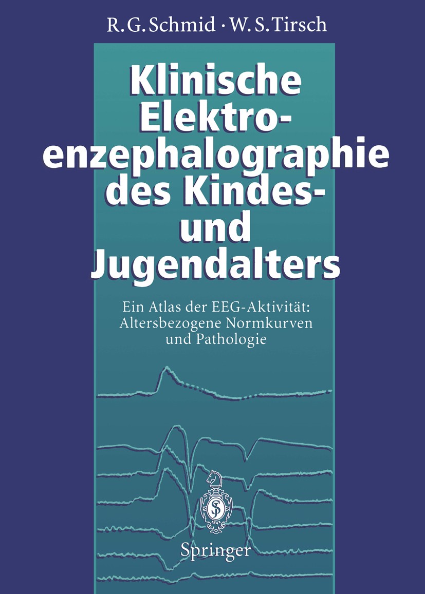 Titlebook: Klinische Elektroenzephalographie des Kindes- und Jugendalters; Ein Atlas der EEG-Ak Ronald G. Schmid,Werner S. Tirsch Book 1995 Springer-V Titlebook: Klinische Elektroenzephalographie des Kindes- und Jugendalters; Ein Atlas der EEG-Ak Ronald G. Schmid,Werner S. Tirsch Book 1995 Springer-V