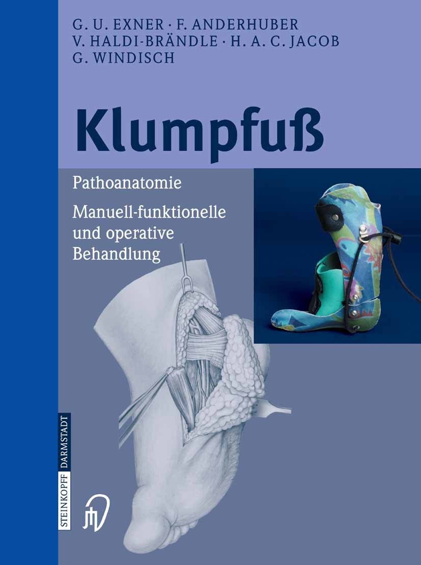 Titlebook: Klumpfuß; Pathoanatomie, Manue G. Ulrich Exner,Friedrich Anderhuber,Gunther Windi Book 2005 Steinkopff-Verlag Darmstadt 2005 Anatomie.Biome Titlebook: Klumpfuß; Pathoanatomie, Manue G. Ulrich Exner,Friedrich Anderhuber,Gunther Windi Book 2005 Steinkopff-Verlag Darmstadt 2005 Anatomie.Biome