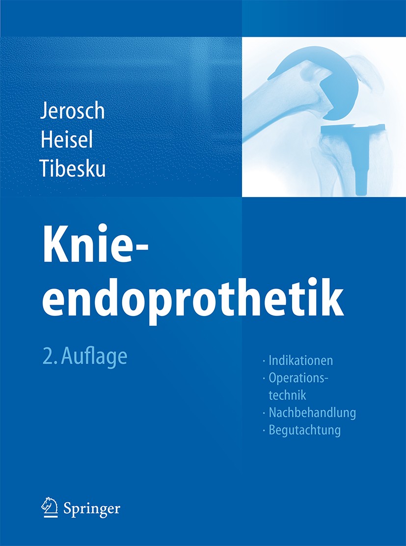 Titlebook: Knieendoprothetik; Indikationen, Operat Jörg Jerosch,Jürgen Heisel,Carsten O. Tibesku Book 2015Latest edition Springer-Verlag Berlin Heidel Titlebook: Knieendoprothetik; Indikationen, Operat Jörg Jerosch,Jürgen Heisel,Carsten O. Tibesku Book 2015Latest edition Springer-Verlag Berlin Heidel