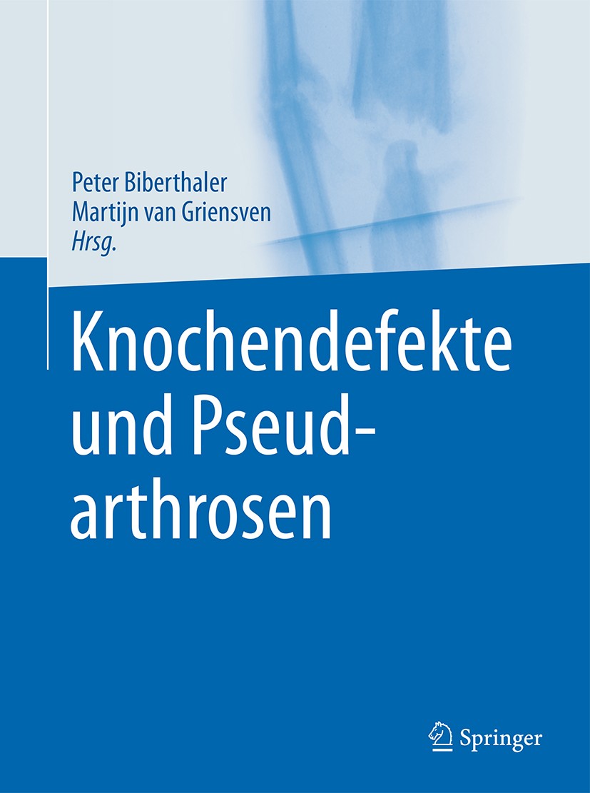 Titlebook: Knochendefekte und Pseudarthrosen; Peter Biberthaler,Martijn van Griensven Book 2017 Springer-Verlag GmbH Deutschland 2017 Akute traumatis Titlebook: Knochendefekte und Pseudarthrosen; Peter Biberthaler,Martijn van Griensven Book 2017 Springer-Verlag GmbH Deutschland 2017 Akute traumatis
