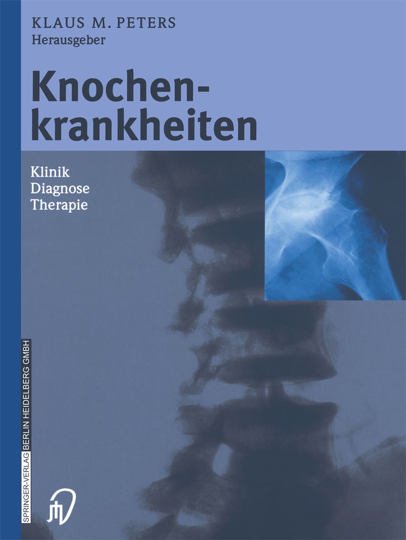 Titlebook: Knochenkrankheiten; Klinik Diagnose Ther Klaus M. Peters (Vorsitzender der Sektion Osteolog Book 2002 Springer-Verlag Berlin Heidelberg 200 Titlebook: Knochenkrankheiten; Klinik Diagnose Ther Klaus M. Peters (Vorsitzender der Sektion Osteolog Book 2002 Springer-Verlag Berlin Heidelberg 200