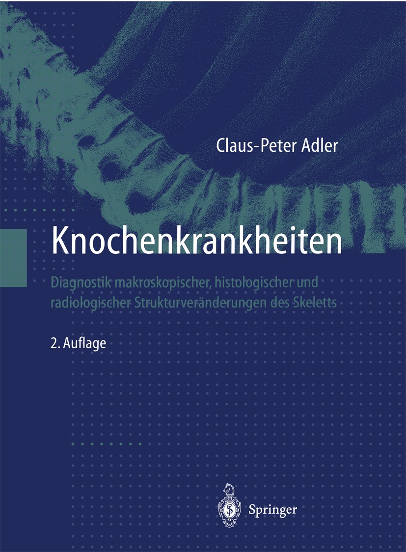 Titlebook: Knochenkrankheiten; Diagnostik makroskop Claus-Peter Adler Book 1998Latest edition Springer-Verlag Berlin Heidelberg 1998 Anatomie.Diagnose Titlebook: Knochenkrankheiten; Diagnostik makroskop Claus-Peter Adler Book 1998Latest edition Springer-Verlag Berlin Heidelberg 1998 Anatomie.Diagnose