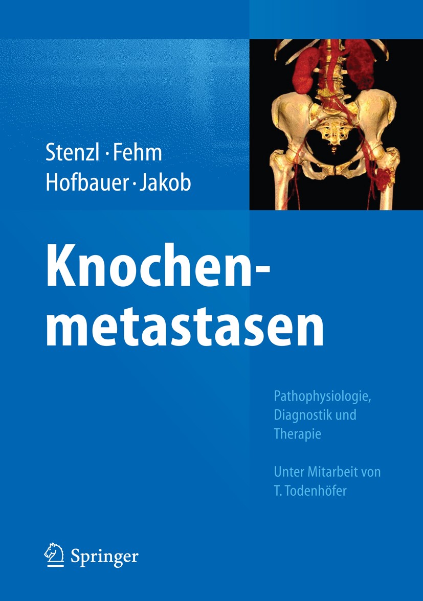 Titlebook: Knochenmetastasen; Pathophysiologie, Di Arnulf Stenzl,Tanja Fehm,Franz Jakob Book 2014 Springer-Verlag Berlin Heidelberg 2014 Knochenmetast Titlebook: Knochenmetastasen; Pathophysiologie, Di Arnulf Stenzl,Tanja Fehm,Franz Jakob Book 2014 Springer-Verlag Berlin Heidelberg 2014 Knochenmetast