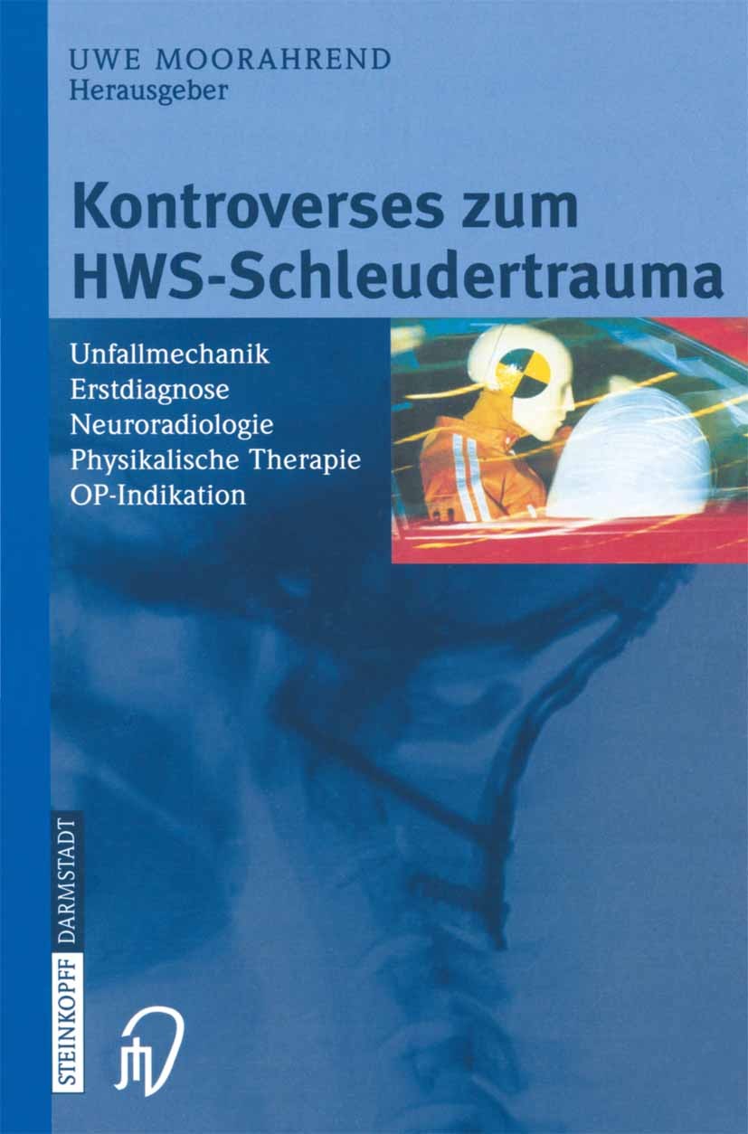Titlebook: Kontroverses zum HWS-Schleudertrauma; Unfallmechanik Erstd Uwe Moorahrend Book 2003 Springer-Verlag Berlin Heidelberg 2003 Biomechanik.Diag Titlebook: Kontroverses zum HWS-Schleudertrauma; Unfallmechanik Erstd Uwe Moorahrend Book 2003 Springer-Verlag Berlin Heidelberg 2003 Biomechanik.Diag