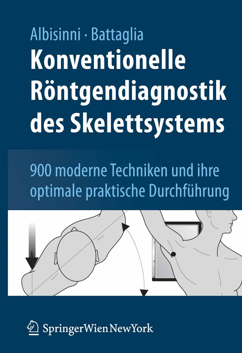 Titlebook: Konventionelle Röntgendiagnostik des Skelettsystems; 900 moderne Technike Ugo Albisinni,Milva Battaglia Book 2008 Springer-Verlag Vienna 20 Titlebook: Konventionelle Röntgendiagnostik des Skelettsystems; 900 moderne Technike Ugo Albisinni,Milva Battaglia Book 2008 Springer-Verlag Vienna 20