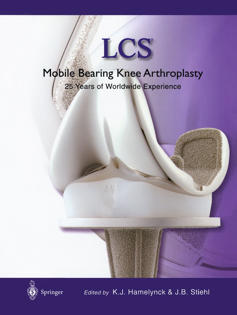 Titlebook: LCS® Mobile Bearing Knee Arthroplasty; A 25 Years Worldwide Karel J. Hamelynck,James B. Stiehl Book 2002 Springer-Verlag Berlin Heidelberg Titlebook: LCS® Mobile Bearing Knee Arthroplasty; A 25 Years Worldwide Karel J. Hamelynck,James B. Stiehl Book 2002 Springer-Verlag Berlin Heidelberg