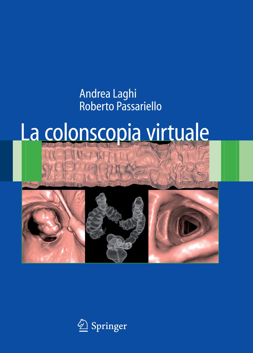 Titlebook: La colonscopia virtuale; Andrea Laghi,Roberto Passariello Book 2008 Springer-Verlag Milan 2008 Tumor.cancro colo-rettale.carcinoma.colon.s Titlebook: La colonscopia virtuale; Andrea Laghi,Roberto Passariello Book 2008 Springer-Verlag Milan 2008 Tumor.cancro colo-rettale.carcinoma.colon.s