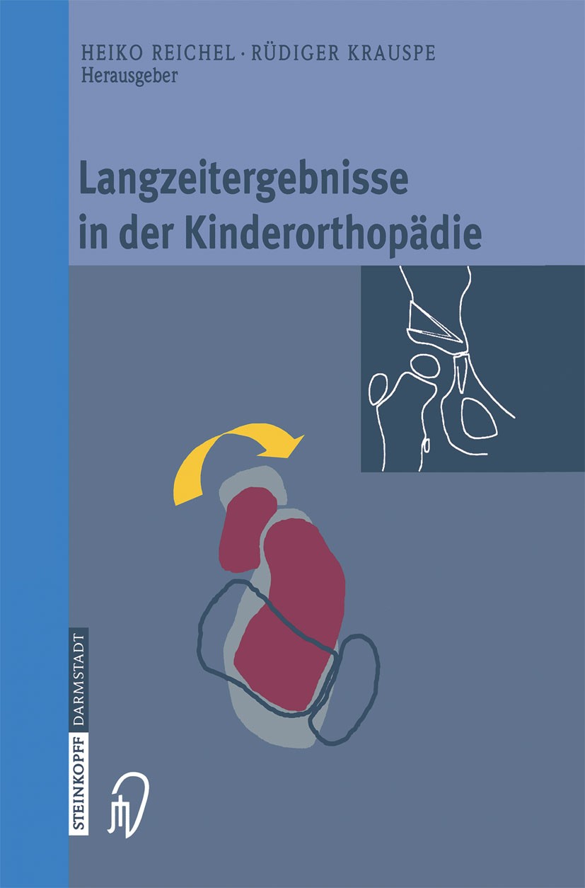 Titlebook: Langzeitergebnisse in der Kinderorthopädie; Heiko Reichel (Leitender Oberarzt),Rüdiger Krauspe Book 2003 Springer-Verlag Berlin Heidelberg Titlebook: Langzeitergebnisse in der Kinderorthopädie; Heiko Reichel (Leitender Oberarzt),Rüdiger Krauspe Book 2003 Springer-Verlag Berlin Heidelberg