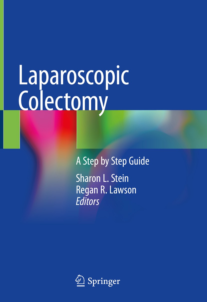 Titlebook: Laparoscopic Colectomy; A Step by Step Guide Sharon L. Stein,Regan R. Lawson Book 2020 Springer Nature Switzerland AG 2020 Left/sigmoid col Titlebook: Laparoscopic Colectomy; A Step by Step Guide Sharon L. Stein,Regan R. Lawson Book 2020 Springer Nature Switzerland AG 2020 Left/sigmoid col