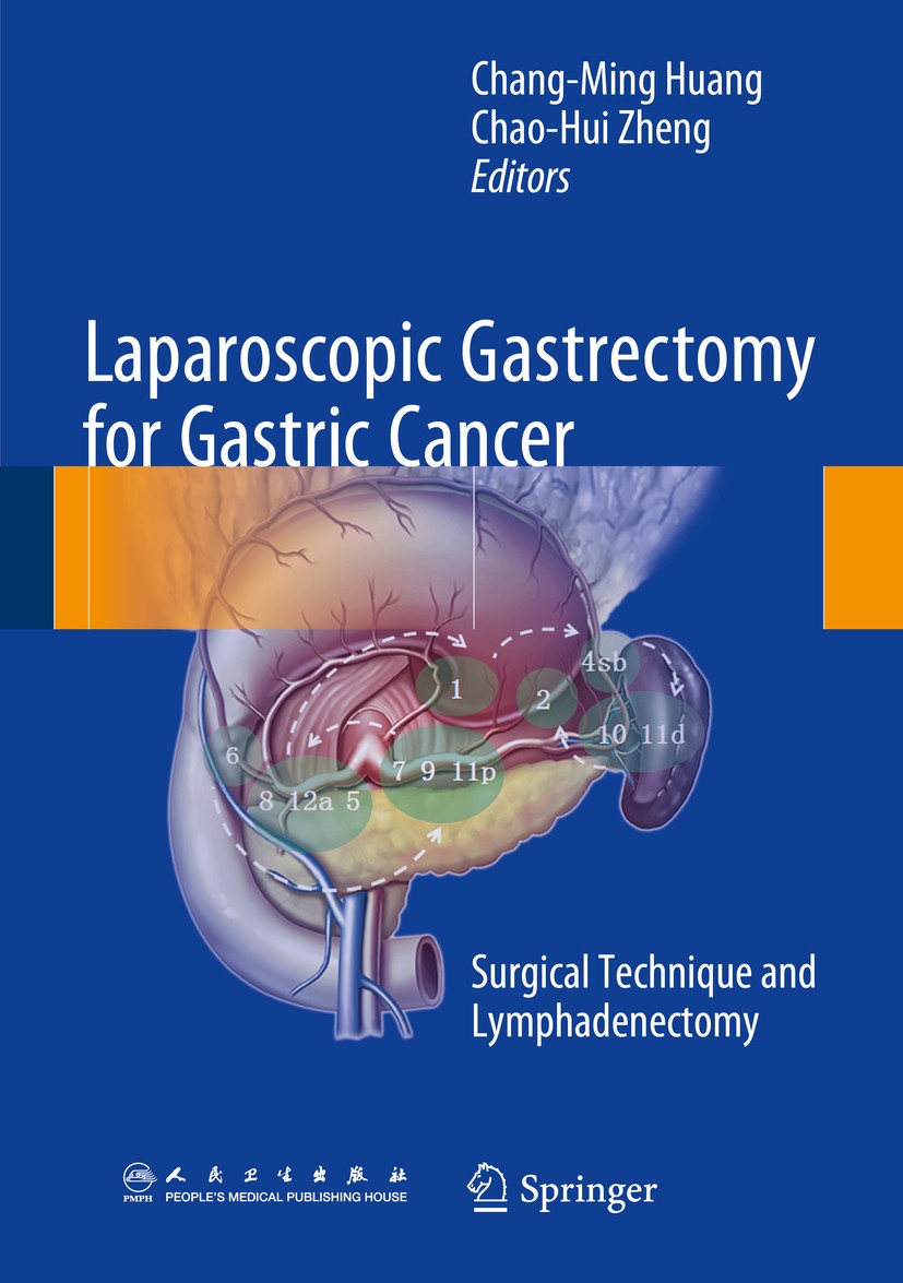 Titlebook: Laparoscopic Gastrectomy for Gastric Cancer; Surgical Technique a Chang-Ming Huang,Chao-Hui Zheng Book 2015 Springer Science+Business Media Titlebook: Laparoscopic Gastrectomy for Gastric Cancer; Surgical Technique a Chang-Ming Huang,Chao-Hui Zheng Book 2015 Springer Science+Business Media