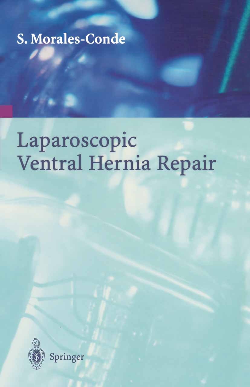 Titlebook: Laparoscopic Ventral Hernia Repair; Salvador Morales-Conde,Salvador Morales-Méndez Textbook 2003 Springer-Verlag France 2003 Abdominal wal Titlebook: Laparoscopic Ventral Hernia Repair; Salvador Morales-Conde,Salvador Morales-Méndez Textbook 2003 Springer-Verlag France 2003 Abdominal wal