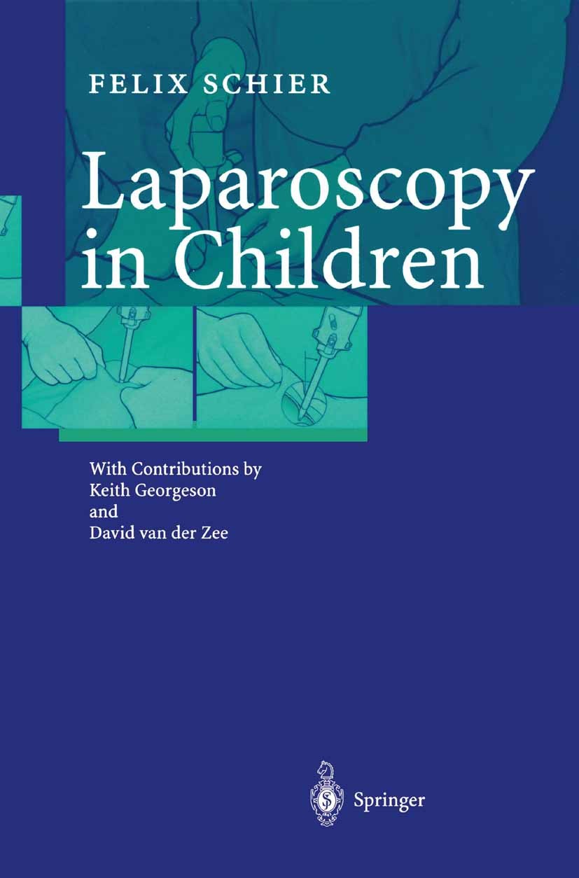 Titlebook: Laparoscopy in Children; Felix Schier Book 20031st edition Springer-Verlag Berlin Heidelberg 2003 Chirurgie.Kinderchirurgie.Laparascopic s Titlebook: Laparoscopy in Children; Felix Schier Book 20031st edition Springer-Verlag Berlin Heidelberg 2003 Chirurgie.Kinderchirurgie.Laparascopic s