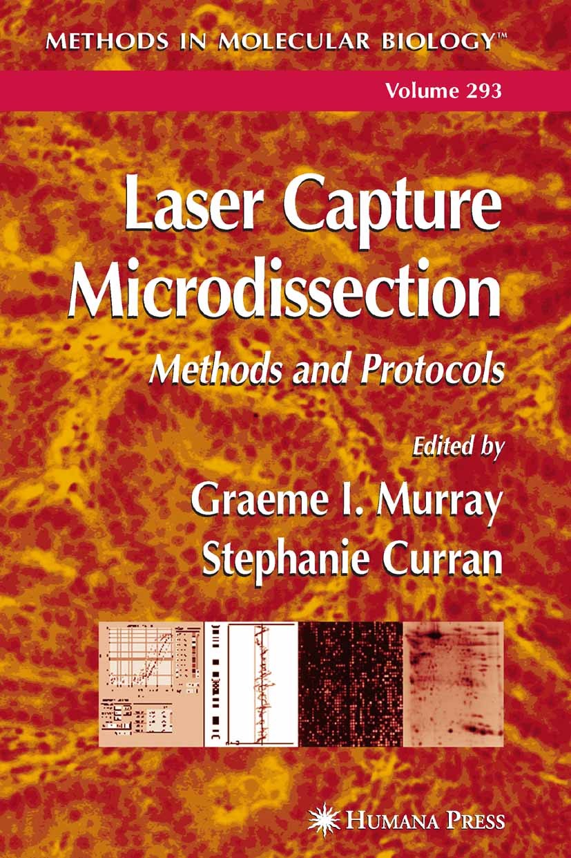 Titlebook: Laser Capture Microdissection; Methods and Protocol Graeme I. Murray,Stephanie Curran Book 20051st edition Humana Press 2005 DNA.Microarray Titlebook: Laser Capture Microdissection; Methods and Protocol Graeme I. Murray,Stephanie Curran Book 20051st edition Humana Press 2005 DNA.Microarray