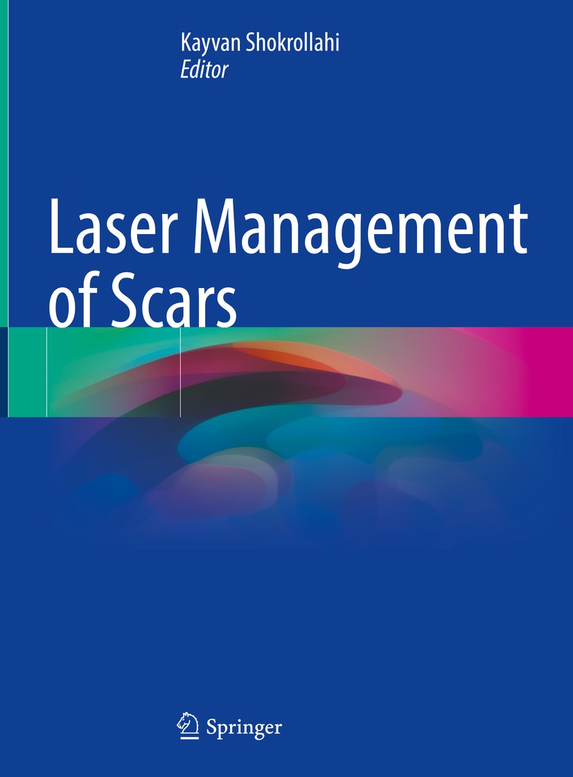 Titlebook: Laser Management of Scars; Kayvan Shokrollahi Book 2020 Springer Nature Switzerland AG 2020 Keloid scars.Erbium:YAG.Non-ablative technolog Titlebook: Laser Management of Scars; Kayvan Shokrollahi Book 2020 Springer Nature Switzerland AG 2020 Keloid scars.Erbium:YAG.Non-ablative technolog