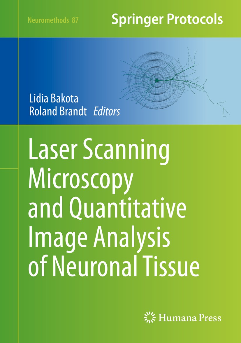 Titlebook: Laser Scanning Microscopy and Quantitative Image Analysis of Neuronal Tissue; Lidia Bakota,Roland Brandt Book 2014 Springer Science+Busine Titlebook: Laser Scanning Microscopy and Quantitative Image Analysis of Neuronal Tissue; Lidia Bakota,Roland Brandt Book 2014 Springer Science+Busine