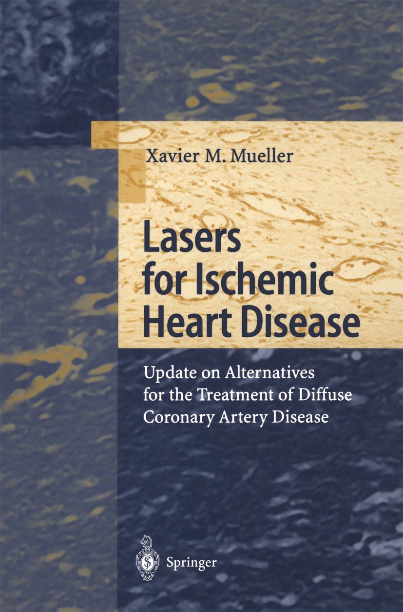 Titlebook: Lasers for Ischemic Heart Disease; Update on Alternativ Xavier M. Mueller Book 2001 Springer-Verlag Berlin Heidelberg 2001 PTCA.anatomy.ang Titlebook: Lasers for Ischemic Heart Disease; Update on Alternativ Xavier M. Mueller Book 2001 Springer-Verlag Berlin Heidelberg 2001 PTCA.anatomy.ang