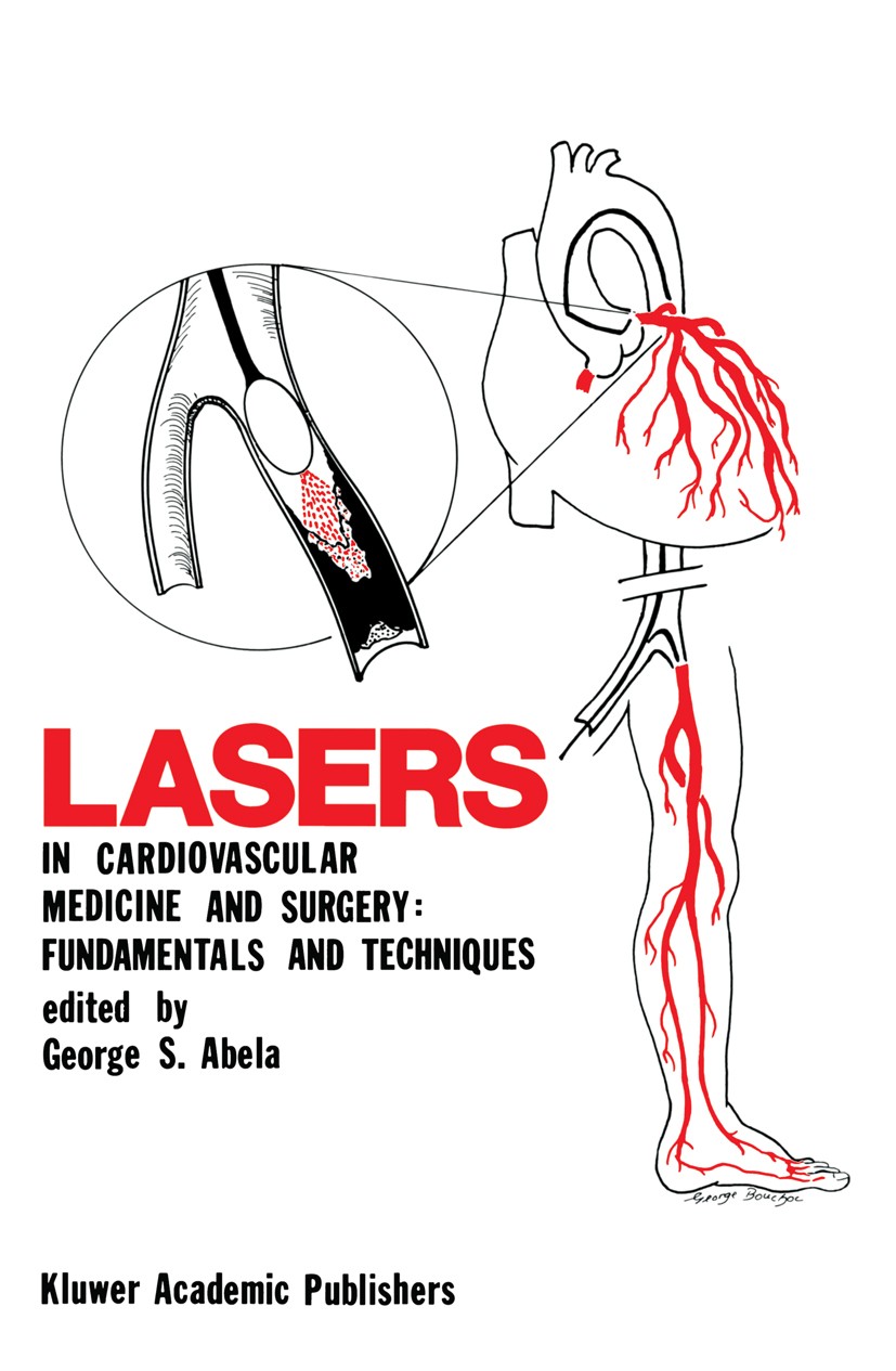 Titlebook: Lasers in Cardiovascular Medicine and Surgery: Fundamentals and Techniques; George S. Abela Book 1990 Kluwer Academic Publishers 1990 Abla Titlebook: Lasers in Cardiovascular Medicine and Surgery: Fundamentals and Techniques; George S. Abela Book 1990 Kluwer Academic Publishers 1990 Abla