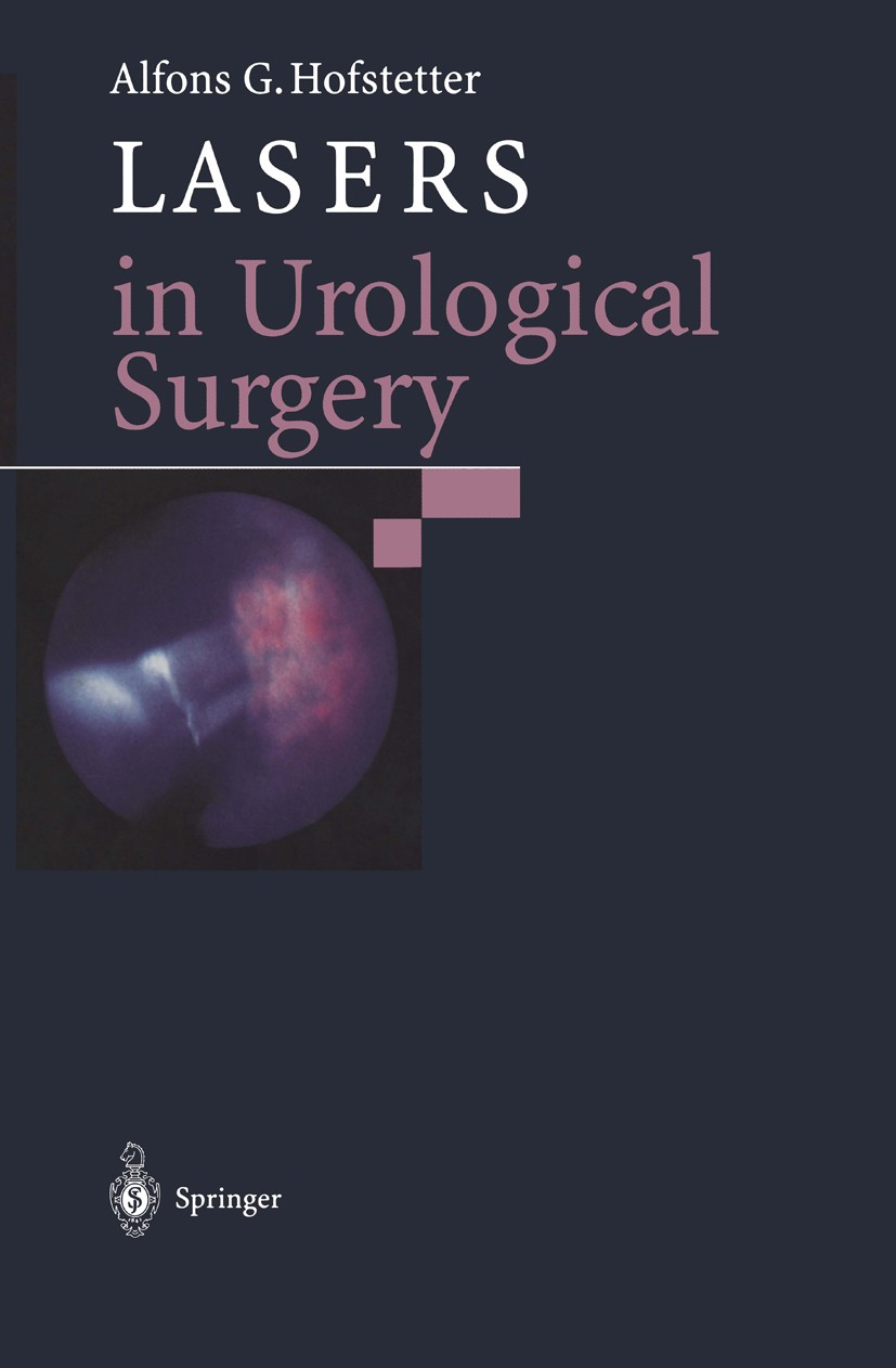 Titlebook: Lasers in Urological Surgery; Alfons G. Hofstetter (Professor of Urology, Direct Book 1997 Springer-Verlag Berlin Heidelberg 1997 cancer.c Titlebook: Lasers in Urological Surgery; Alfons G. Hofstetter (Professor of Urology, Direct Book 1997 Springer-Verlag Berlin Heidelberg 1997 cancer.c