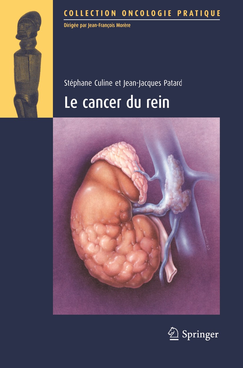 Titlebook: Le Cancer du rein; Stéphane Culine,Jean-Jacques Patard Book 2008Latest edition Springer-Verlag Paris 2008 Biotherapies.Cancer du rein.Chir Titlebook: Le Cancer du rein; Stéphane Culine,Jean-Jacques Patard Book 2008Latest edition Springer-Verlag Paris 2008 Biotherapies.Cancer du rein.Chir