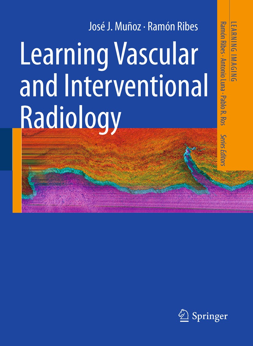 Titlebook: Learning Vascular and Interventional Radiology; José J. Muñoz,Ramón Ribes Book 2010 Springer-Verlag Berlin Heidelberg 2010 Interventional Titlebook: Learning Vascular and Interventional Radiology; José J. Muñoz,Ramón Ribes Book 2010 Springer-Verlag Berlin Heidelberg 2010 Interventional